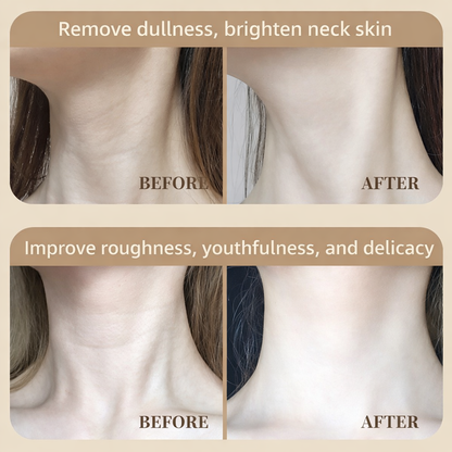 LumiFlex 4 Advanced LED Mask